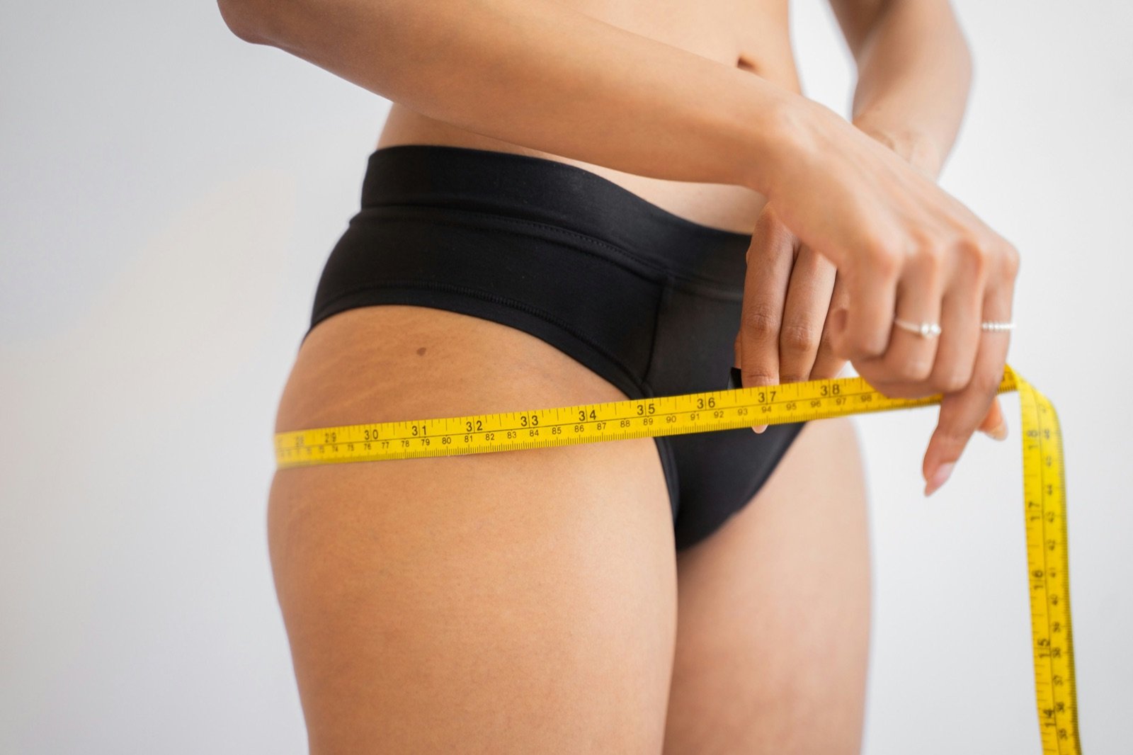 Medically-supervised weight loss